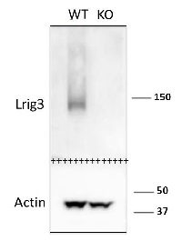 mLrig3-207 | Leucine-rich repeats and immunoglobulin-like domains protein 3 in the group Antibodies for Human/Animal  / Human Proteins / Other Human proteins at Agrisera AB (Antibodies for research) (AS14 2789)